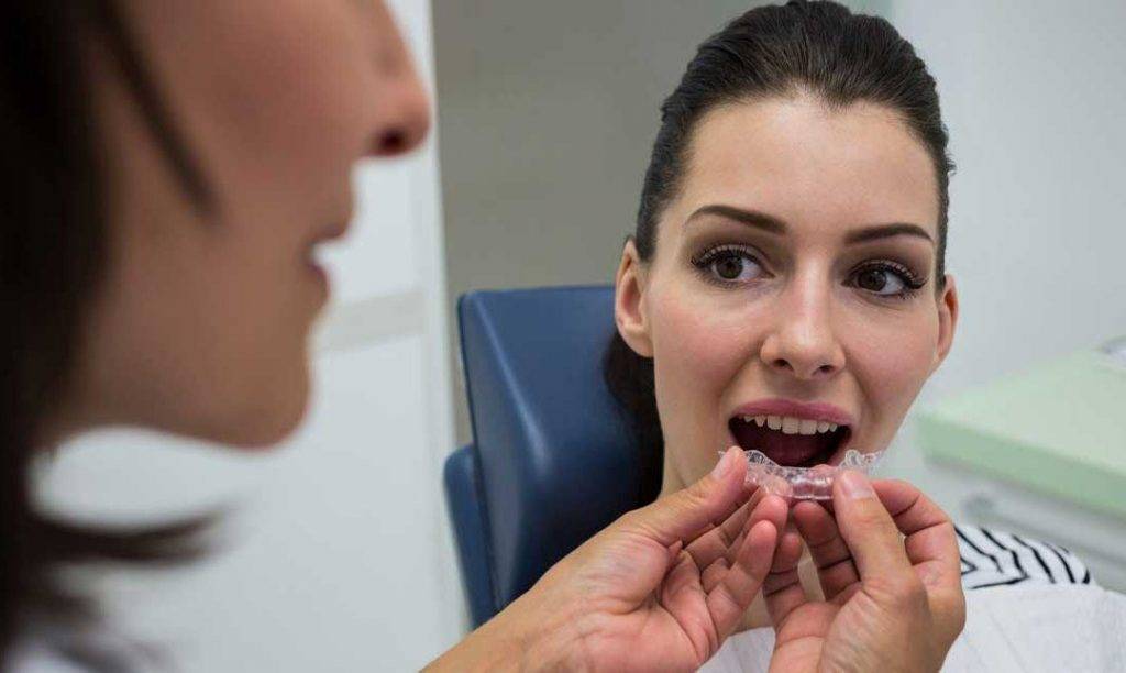Invisalign -  La revolución de la ortodoncia
